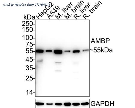 HUABIO ER1803-35 image 1