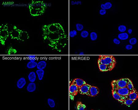 HUABIO ER1803-35 image 2