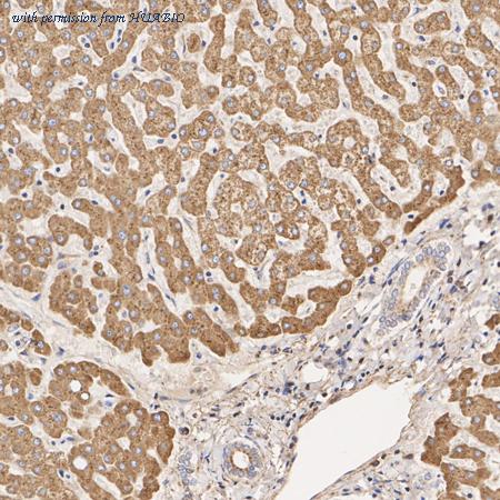 HUABIO ER1803-35 image 3