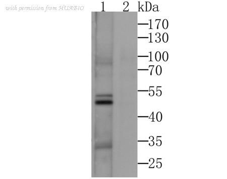 HUABIO ER1803-38 image 1