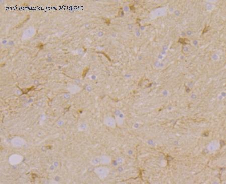 HUABIO ER1803-38 image 3