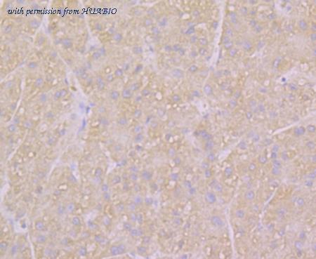 HUABIO ER1803-39 image 3