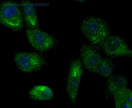 HUABIO ER1803-41 image 2