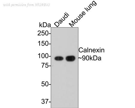 HUABIO ER1803-42 image 1