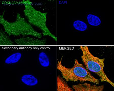 HUABIO ER1803-53 image 3