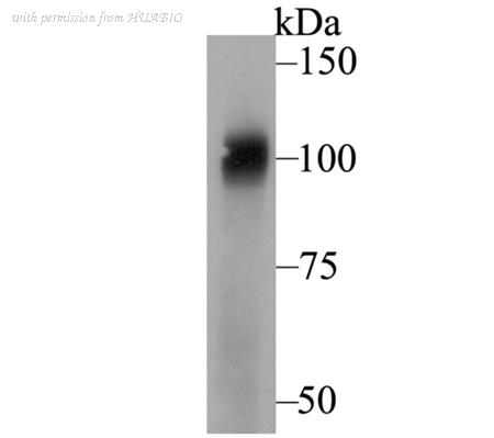 HUABIO ER1803-69 image 1