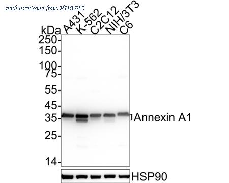 HUABIO ER1803-70 image 1