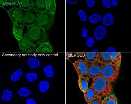 HUABIO ER1803-70 image 2