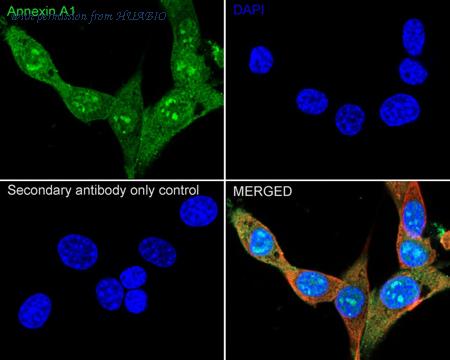 HUABIO ER1803-70 image 3