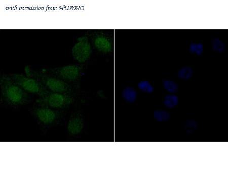 HUABIO ER1803-71 image 3