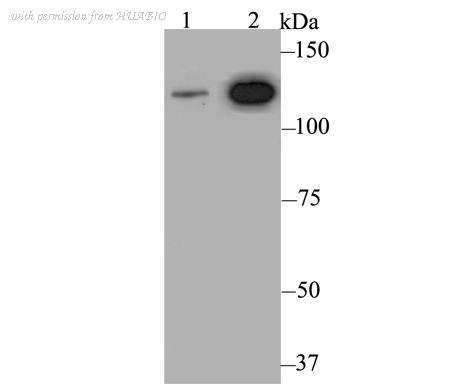 HUABIO ER1803-73 image 1