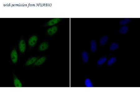 HUABIO ER1803-73 image 3