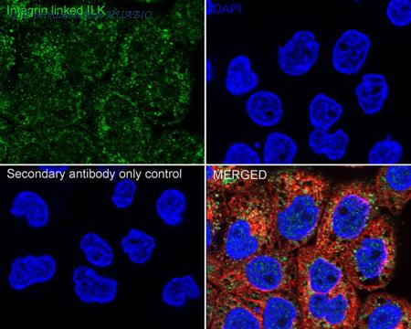 HUABIO ER1803-78 image 2