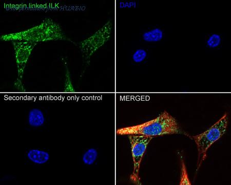 HUABIO ER1803-78 image 3