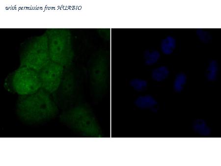 HUABIO ER1803-82 image 2