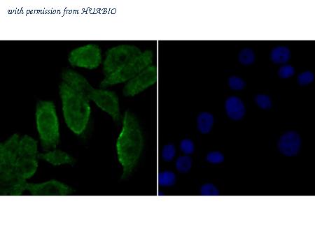 HUABIO ER1803-82 image 3