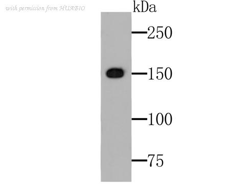 HUABIO ER1803-91 image 1