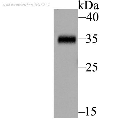 HUABIO ER1803-97 image 1