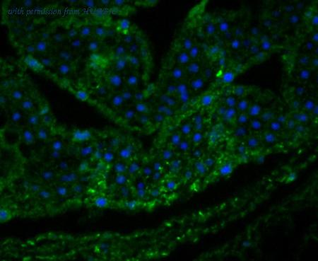 HUABIO ER1901-09 image 2