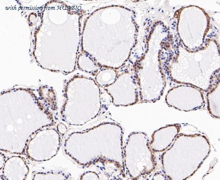 HUABIO ER1901-12 image 2