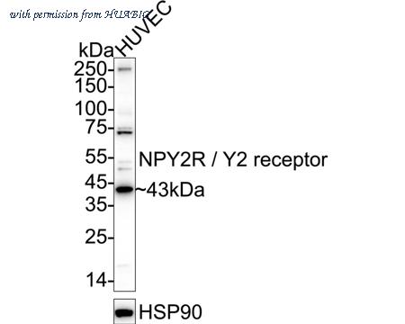 HUABIO ER1901-14 image 1