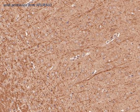 HUABIO ER1901-15 image 2