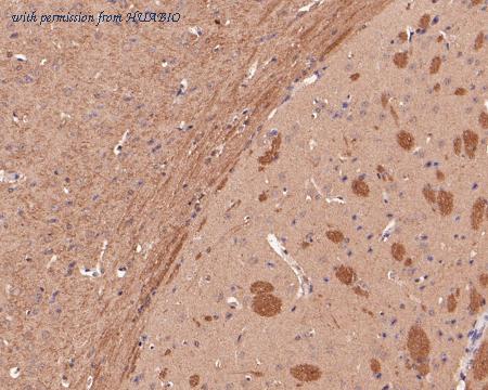 HUABIO ER1901-15 image 3