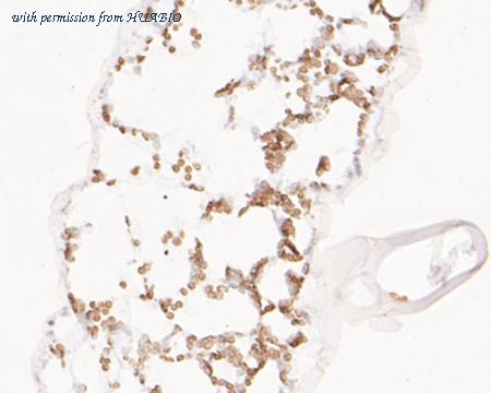 HUABIO ER1901-35 image 2