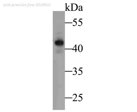 HUABIO ER1901-38 image 1
