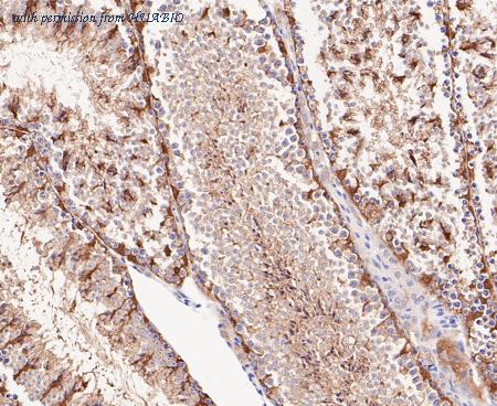 HUABIO ER1901-38 image 3