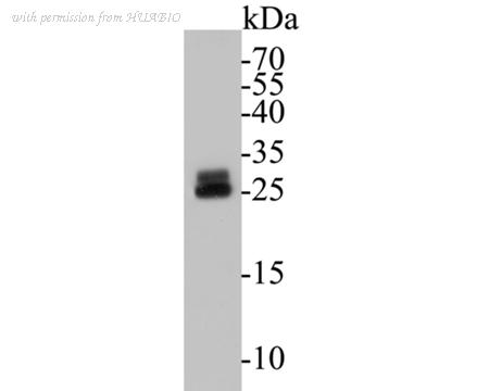HUABIO ER1901-43 image 1