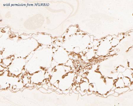 HUABIO ER1901-56 image 2