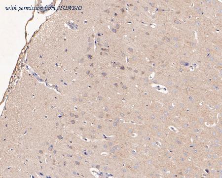 HUABIO ER1901-57 image 3