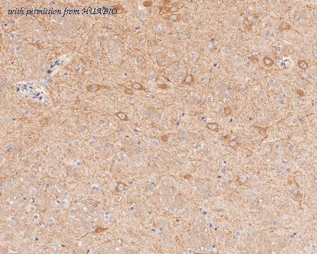 HUABIO ER1901-58 image 3