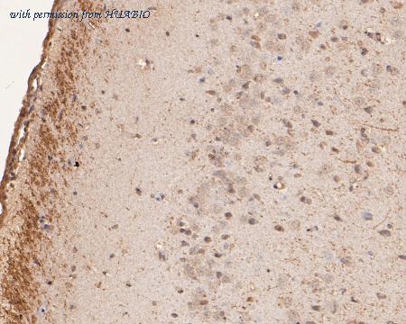 HUABIO ER1901-60 image 2