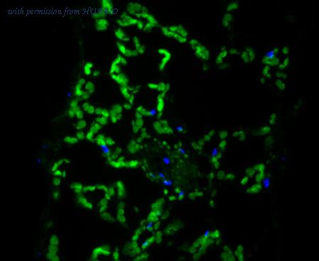 HUABIO ER1901-78 image 1