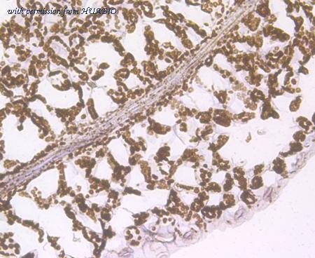 HUABIO ER1901-78 image 2