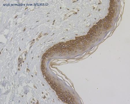 HUABIO ER1901-86 image 2