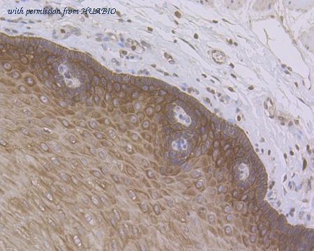 HUABIO ER1901-86 image 3