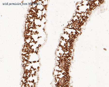 HUABIO ER1902-18 image 2