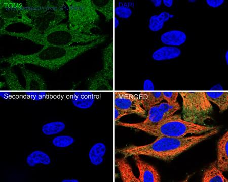 HUABIO ER1902-28 image 3