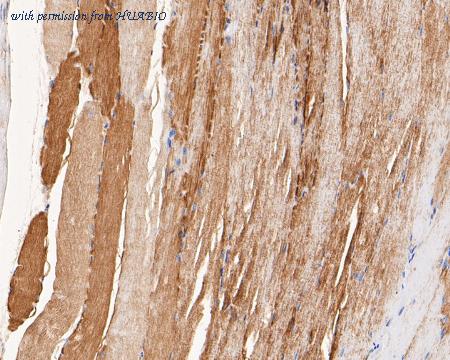 HUABIO ER1902-58 image 3