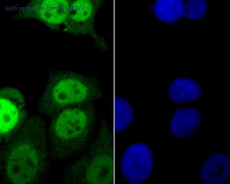 HUABIO ER1902-64 image 2