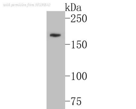 HUABIO ER1902-65 image 1
