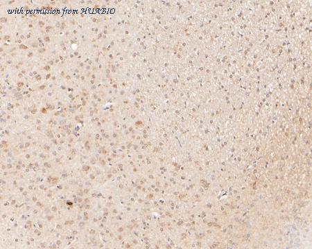 HUABIO ER1902-89 image 2