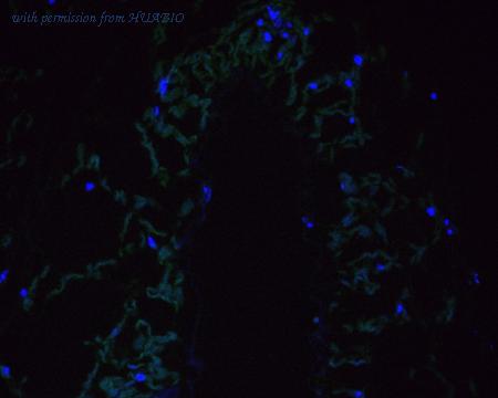 HUABIO ER1902-91 image 2