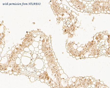 HUABIO ER1902-91 image 3