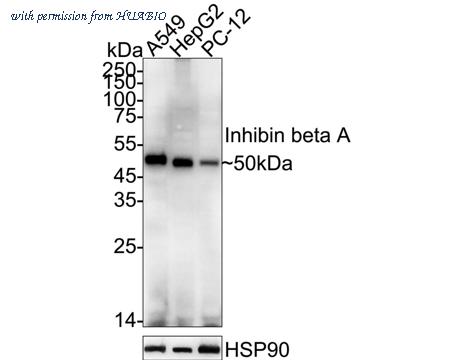HUABIO ER1911-46 image 1