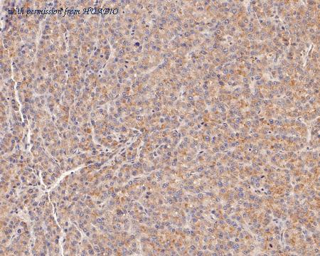 HUABIO ER2001-01 image 3