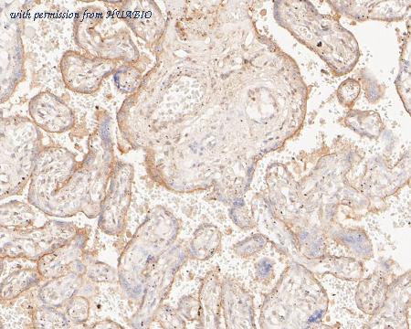 HUABIO ER2001-17 image 2